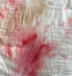 옷에 립스틱 지우기