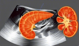 복부초음파 실비보험
