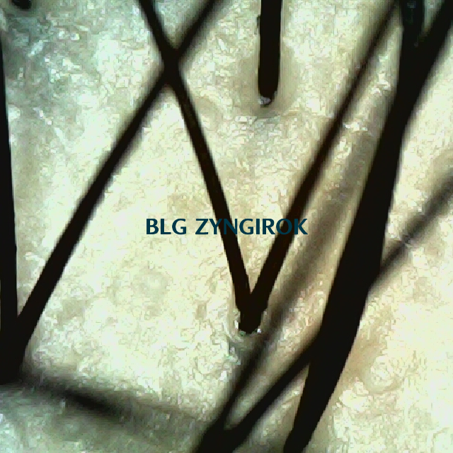 피나모아 복용 28주차 정수리 두피 모습이다.