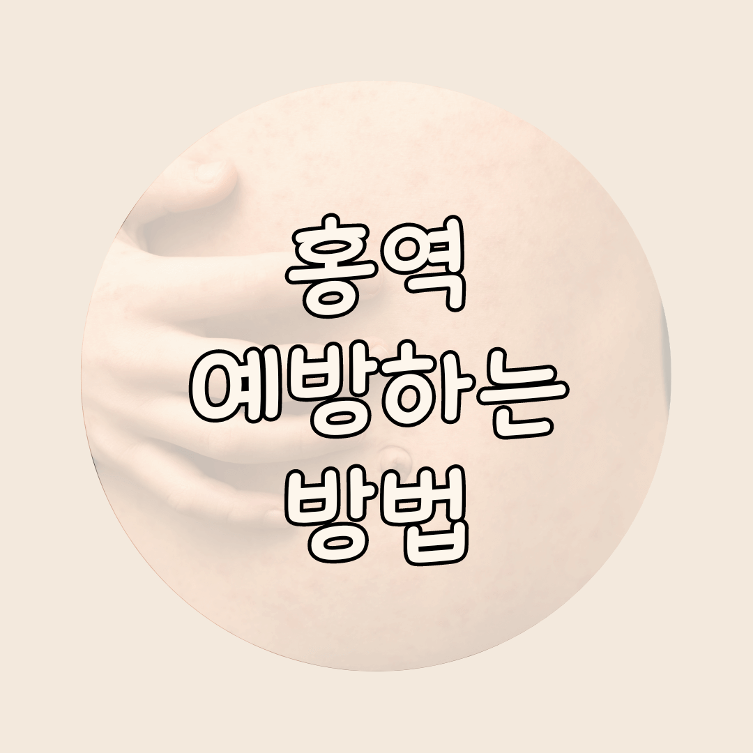 홍역