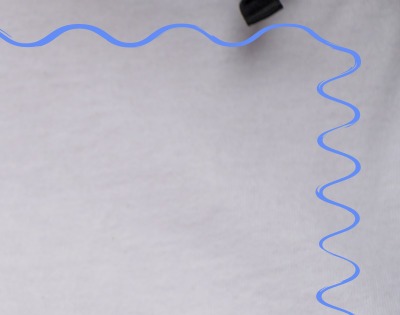 유방암 초기증상