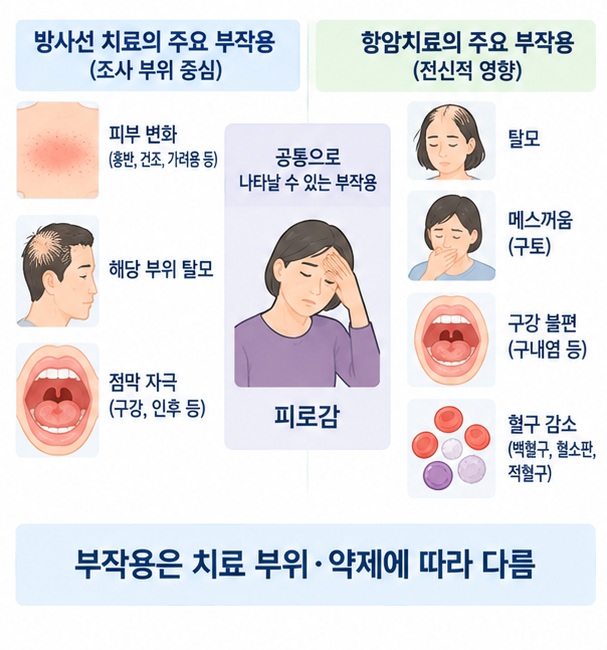 방사선 조사 부위의 부작용과 항암치료의 전신 부작용 차이를 설명하는 이미지