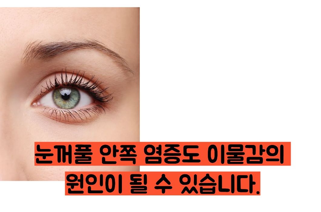 눈에 이물질이 낀것 같은 증상