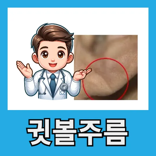 "귓볼 주름"