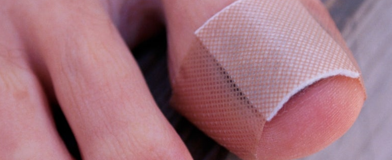 발톱 들렸을 때2