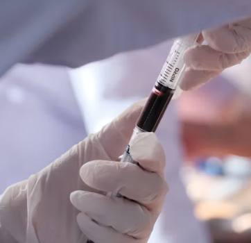 면역력이 떨어졌을 때 증상 저하 체크리스트