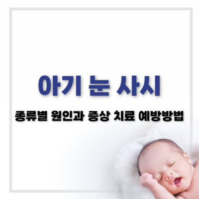 사시 종류, 사시 원인, 사시 치료, 아기 사시 예방, 사시 증상