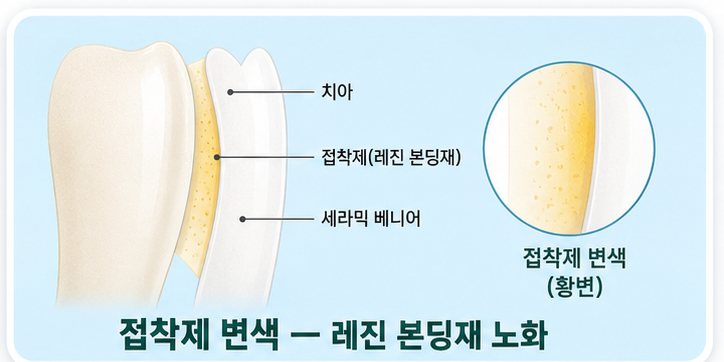 접착제 변색
