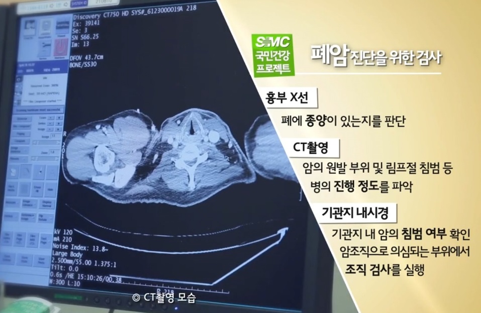 EBS명의-폐명의-심태선-교수