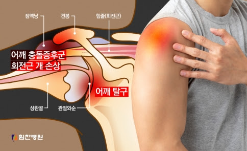 어깨 통증 원인