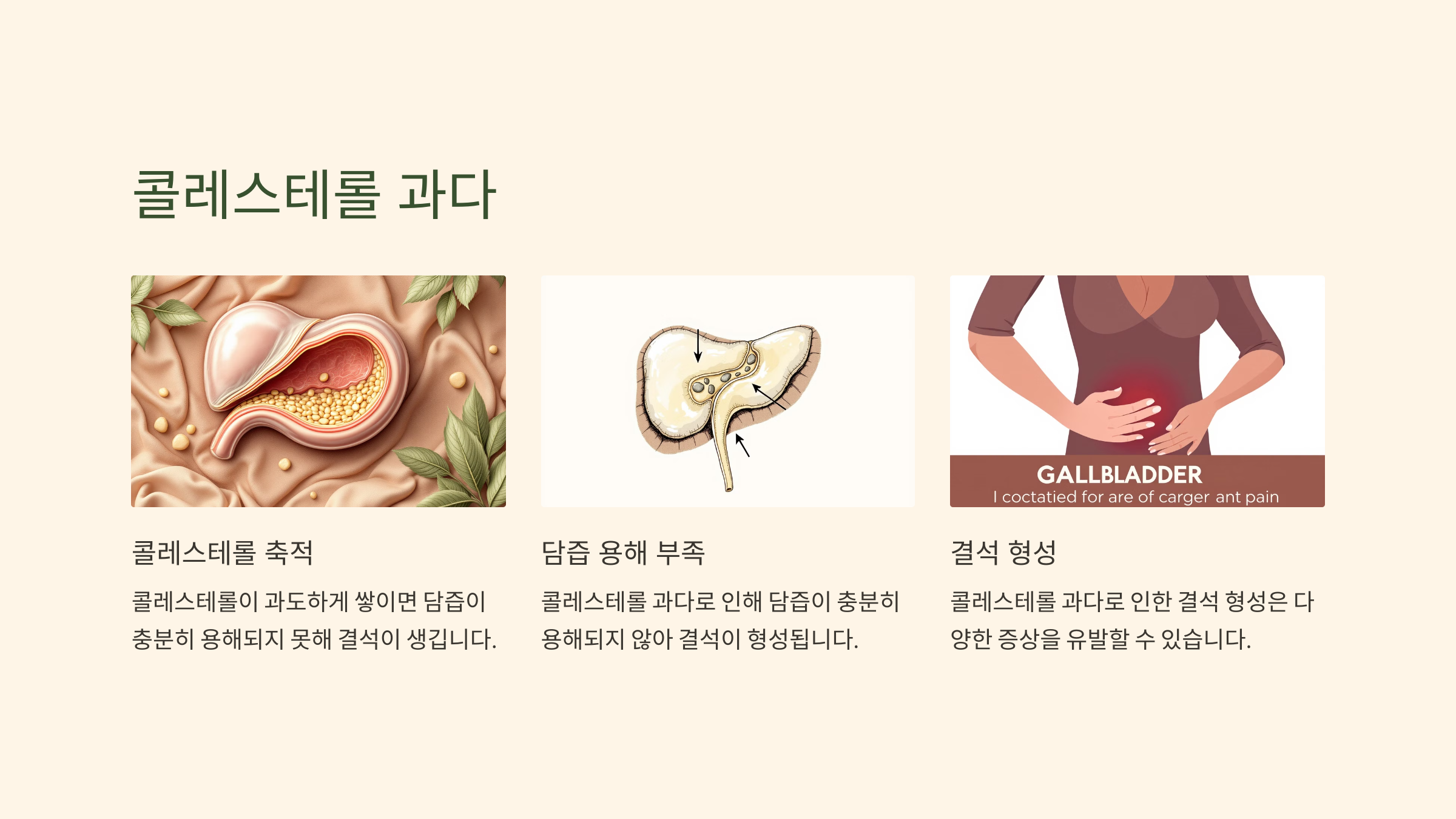 담낭 결석과 관련된 사진