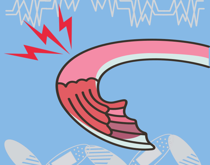 나팔관에 통증이 발생되고 있는 모습