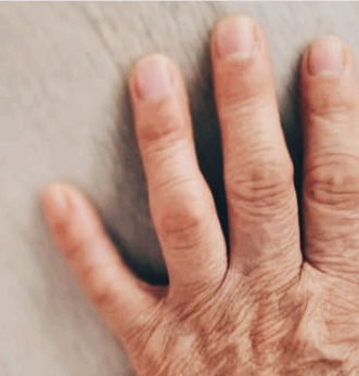 류마티스 관절염 초기증상