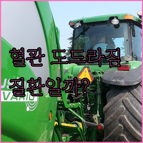 정맥 혈관이 보이는 이유, 질환일까?