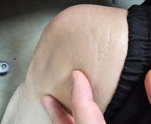 손으로 만지는 무릎