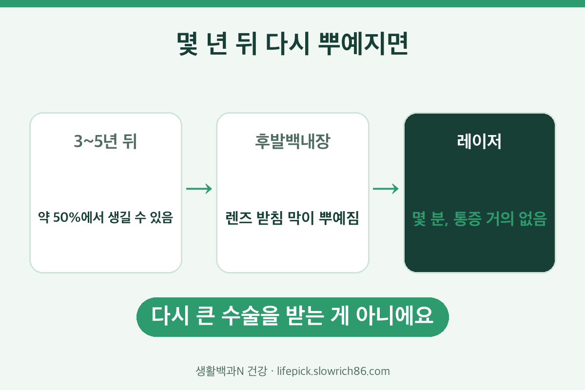 백내장 수술 후 후발백내장 3~5년 레이저 치료