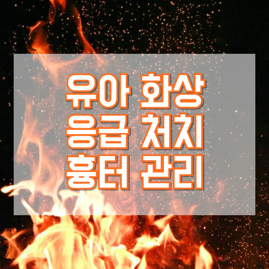 유아 화상 응급 처치 및 흉터 관리