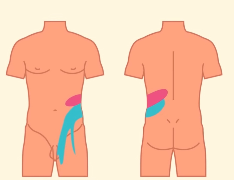 급성 신우신염 증상
