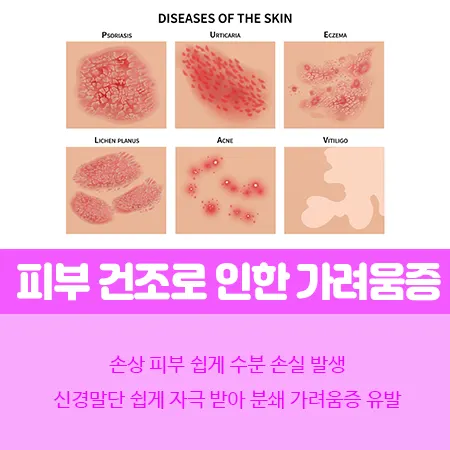 가을철 피부 관리 방법