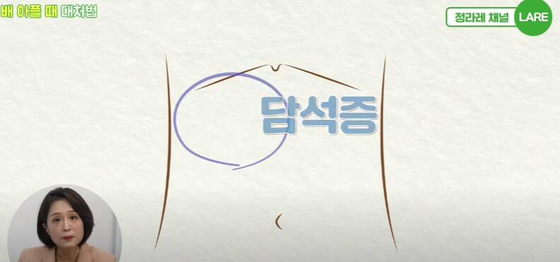 배아플때 대처법, 복부 위치에 따라 통증이 다릅니다.