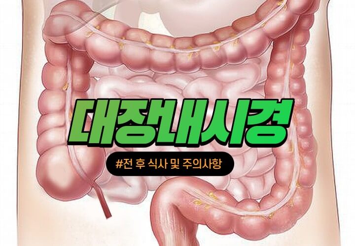 대장내시경 시에는 전 후 식사 및 주의사항을 잘 지키는 것이 중요합니다.