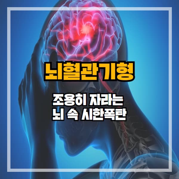 조용히 자라는 뇌 속 시한폭탄, 뇌혈관기형의 모든 것