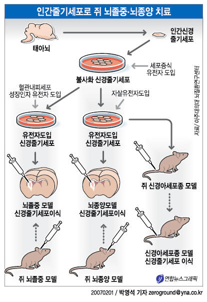 뇌종양