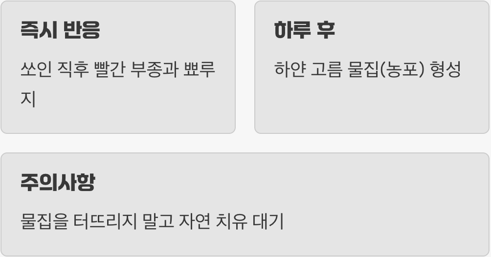 불에 덴 듯한 통증과 '하얀 물집'