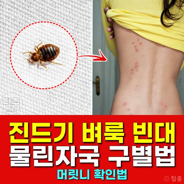 살인진드기 벼룩 빈대 물린자국 구별법,건강