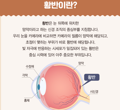 황반변성의 조기 관리와 예방
