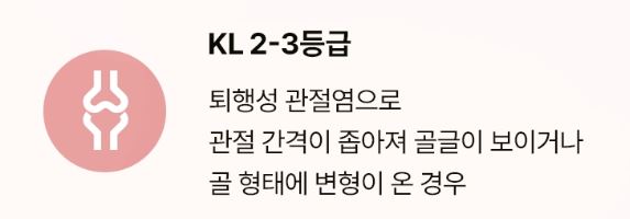 무릎줄기세포주사 가격 및 무릎줄기세포주사 실비 실손 보상 / 전국 병원추천