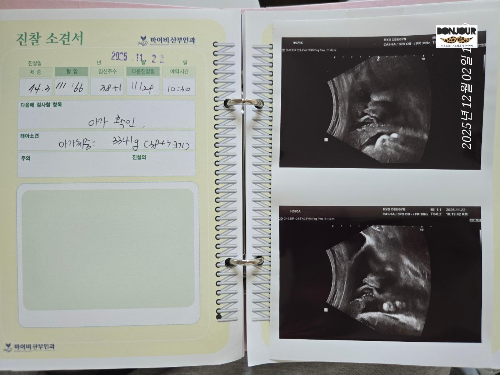 마이비산부인과 아기수첩 38주차 3.3kg 태아의 모습