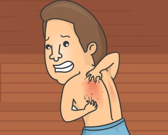 아토피로 고통 받는 남자