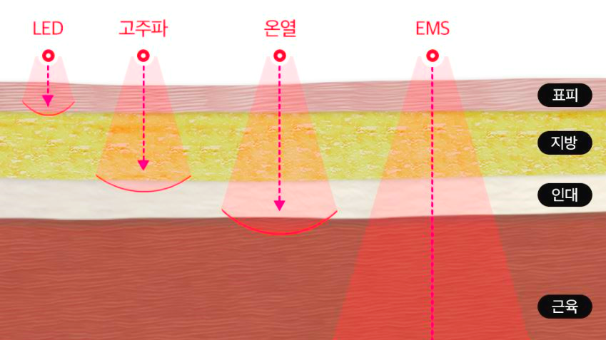  휴그랩 리즈라인 장점