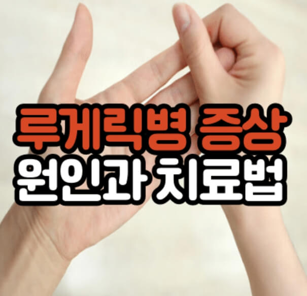 루게릭병 증상