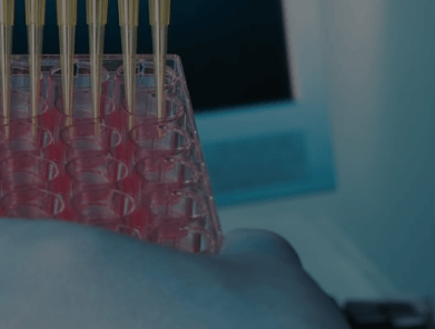 코오롱 티슈진 주가 전망 실적 3상 결과 유상증자 관리종목 심사 최근 이슈