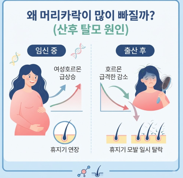산후 탈모 시기