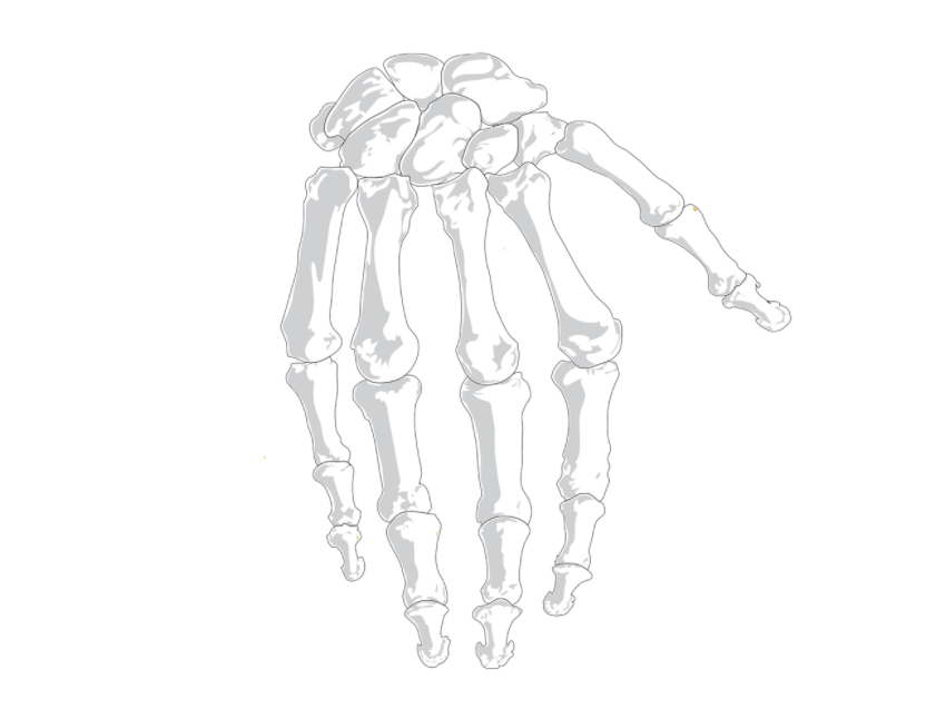 유리뼈병으로 알려진 희귀 유전질환, 골형성부전증(Osteogenesis Imperfecta)