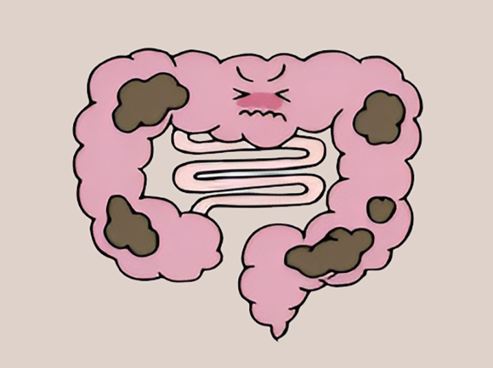 변비에-고통스런-장