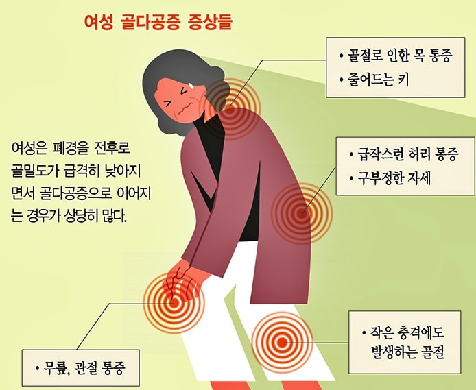 골다공증 초기증상