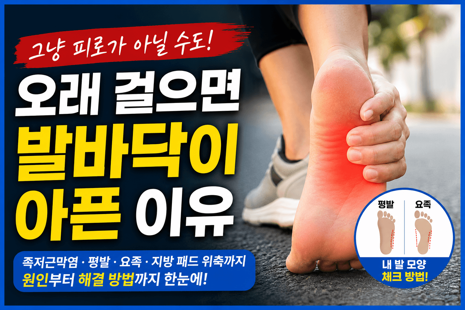 래 걸으면 발바닥이 아픈 이유? 대부분이 놓치는 충격적인 원인
