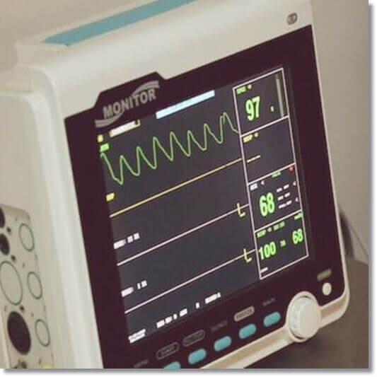부정맥 증상, 원인 및 종류 치료 관리