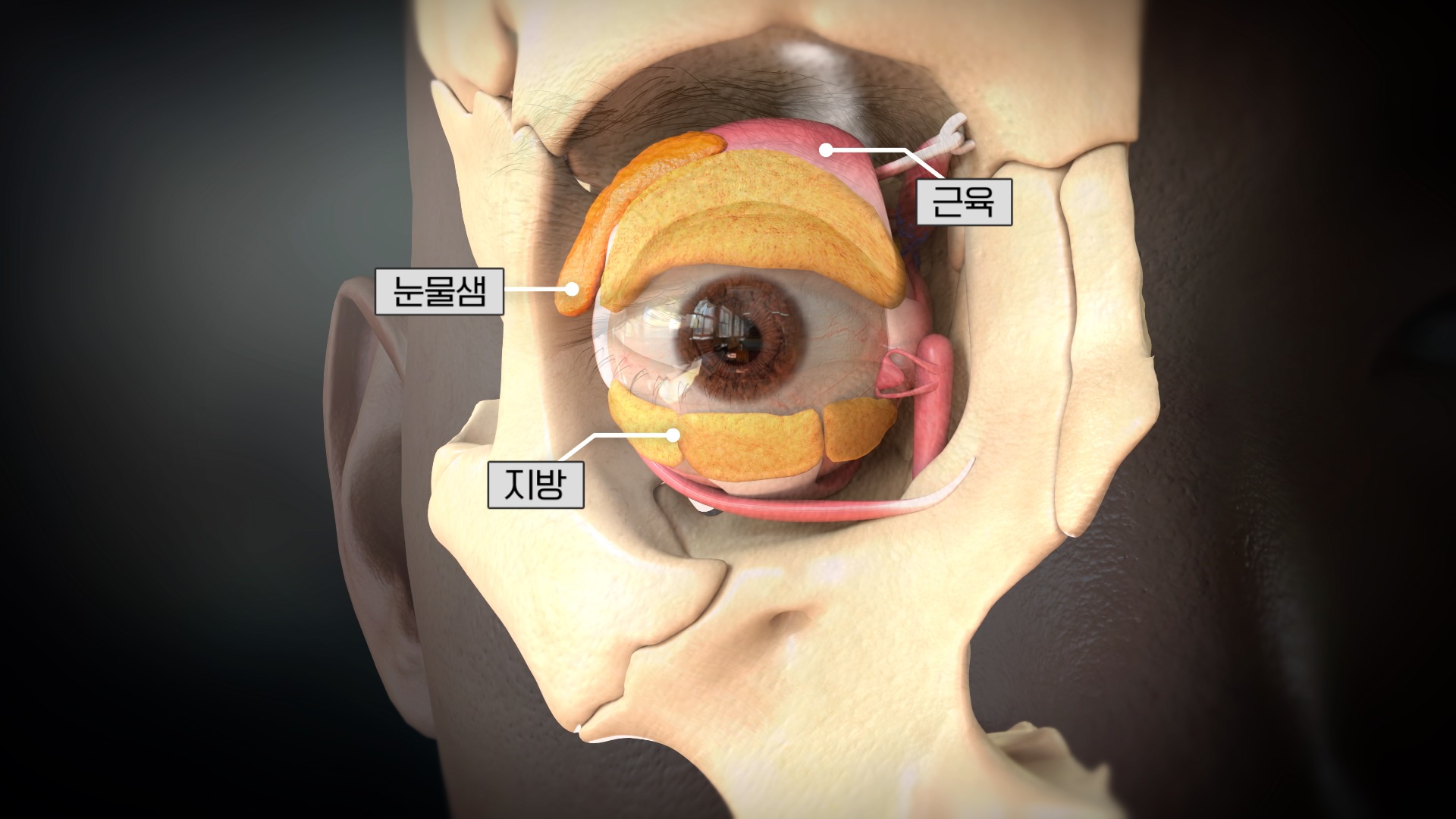 명의 안검하수 안성형