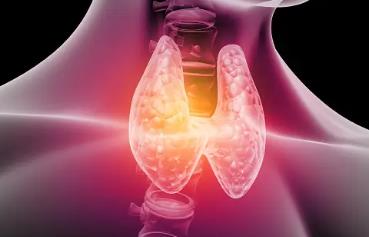 갑상선기능저하증