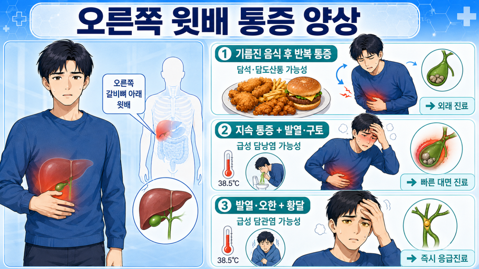 오른쪽 윗배 통증 위치와 담석&middot;급성 담낭염&middot;급성 담관염 가능성을 증상별로 구분한 안내