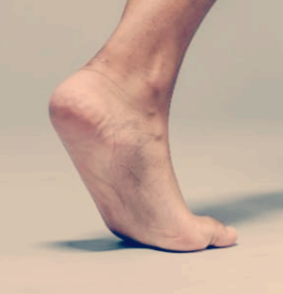 발저림 원인 증상&amp;#44; 치료법과 병원 선택까지