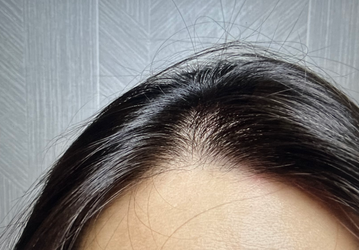 디에이드 옥시덴스 사용 전 머리 상태