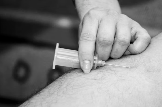 급성구획증후군 정형외과 응급 진단 치료