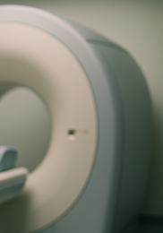 뇌졸중 전조증상