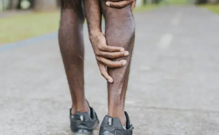 하지 정맥류 증상 23